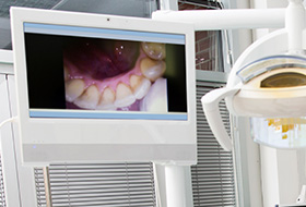 Intraoral photo on computer