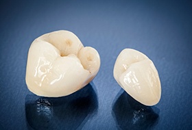 A closeup of metal-free ceramic dental crowns