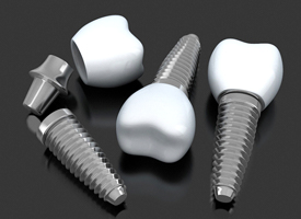 dental implants in Pittsburgh on dark background