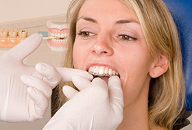 Dentist placing Invisalign tray