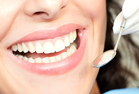 Closeup of health smile