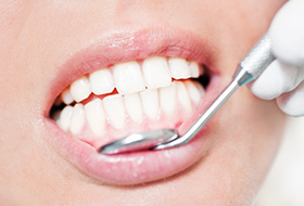 Closeup of healthy teeth and gums