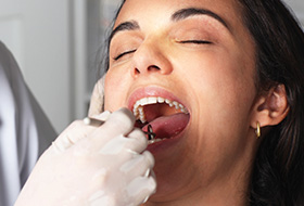 Woman receiving oral cancer screening