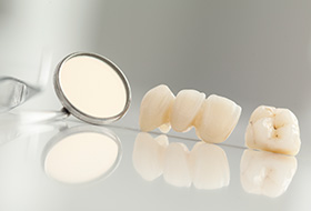 Dental crown and bridge on tabletop
