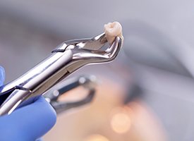 Closeup of an extracted tooth held by forceps