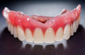 A top arch denture.