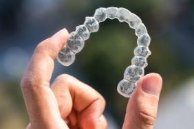 Someone holding up a clear aligner tray