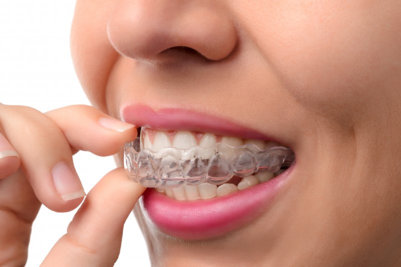 young woman wearing Invisalign aligner